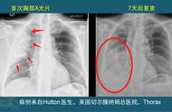 胃扭转、肠扭转，你知道肺扭转吗？藏獒也可能患上这种病